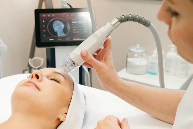 Radiorefraktīvais mikro adatu Rf liftings bez skalpeļa